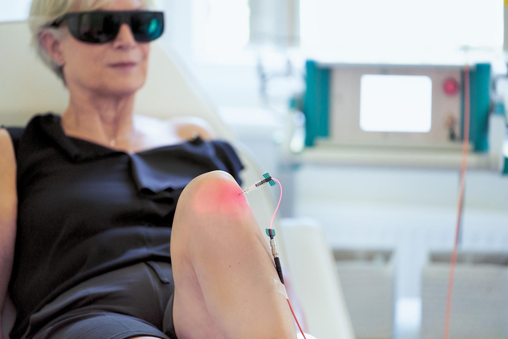 Patient receives intra-articular laser therapy on the knee with a thin probe that is inserted directly into the joint