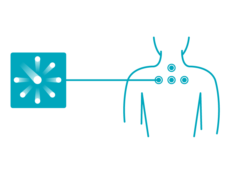 Icon for non-invasive laser therapy: stylized laser beam gently hits skin surface – symbolizes painless light treatment without surgery.
