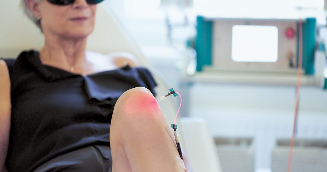 Patient receives intra-articular laser therapy on the knee with a thin probe that is inserted directly into the joint