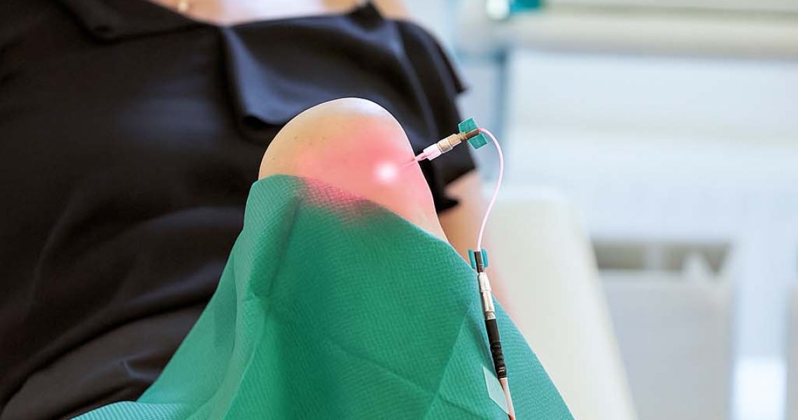 Interstitielle Lasertherapie Kopie